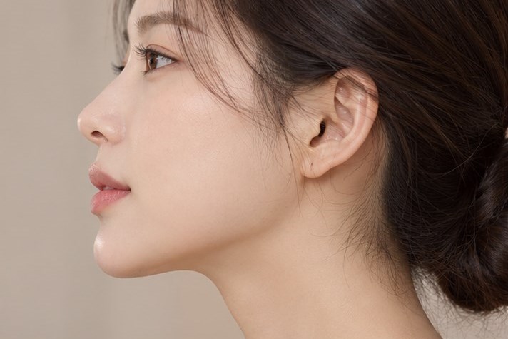 하악각 형태 참고 이미지